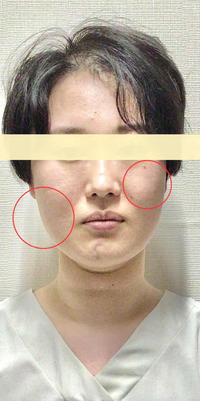 after画像