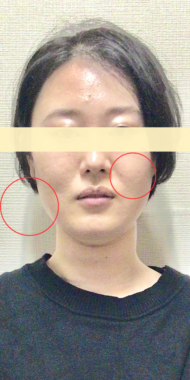 before画像