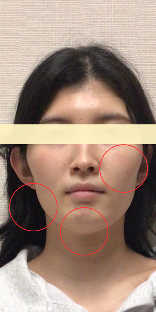 after画像