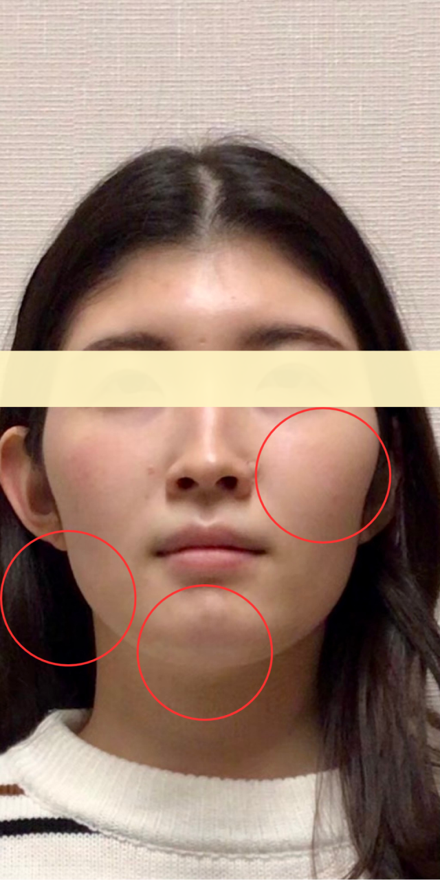 before画像