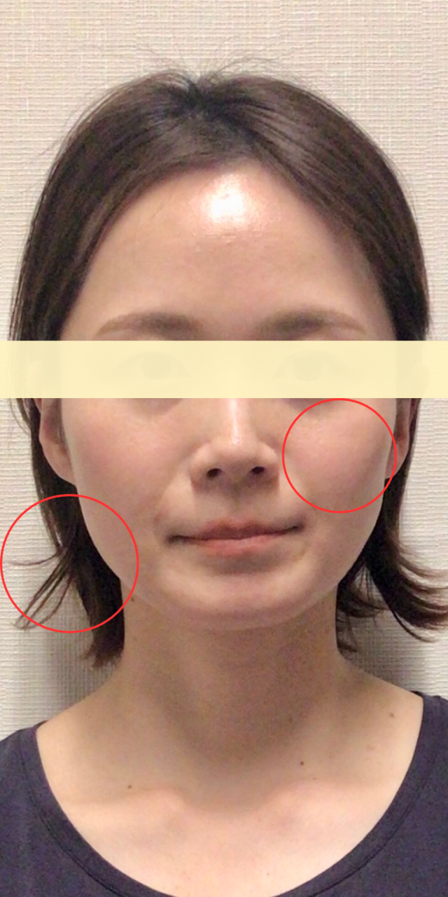 before画像