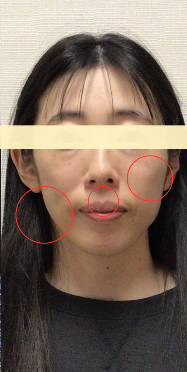 after画像
