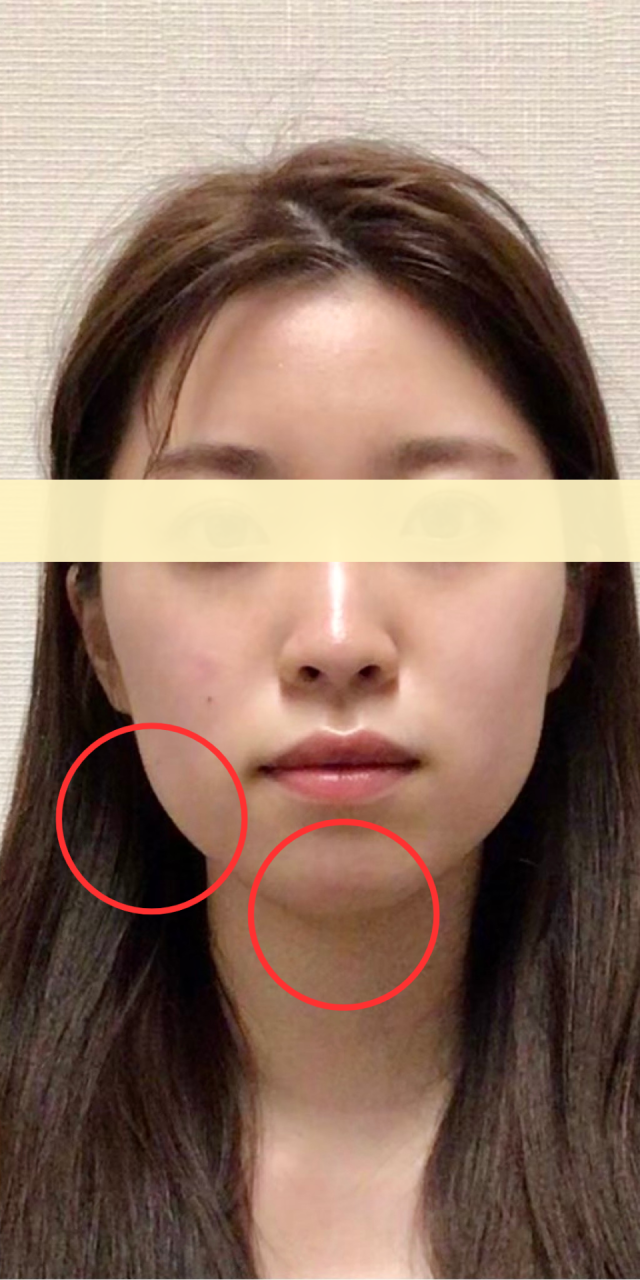 after画像