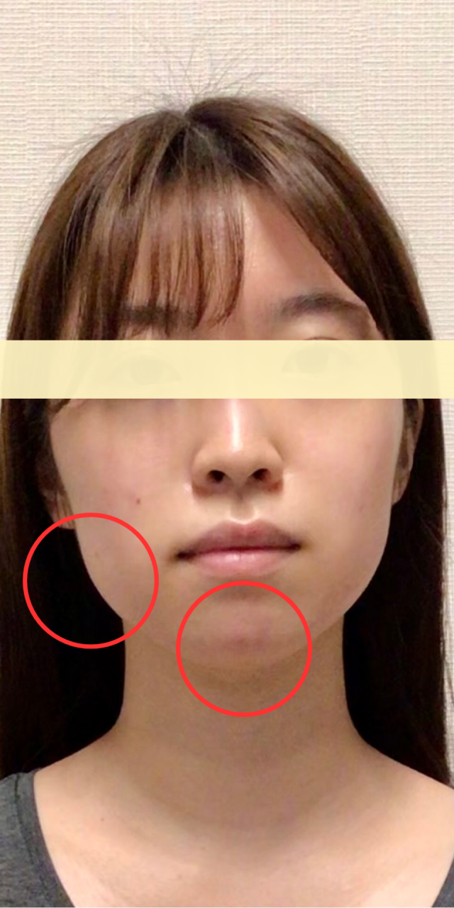before画像