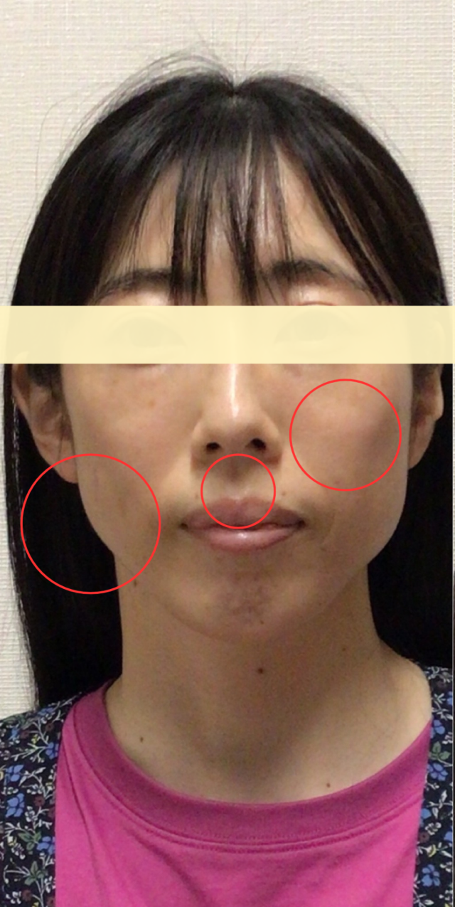 before画像